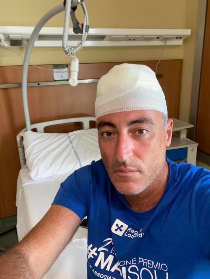 Lavagna, l'assessore Gallera sbatte la testa, 30 punti di sutura