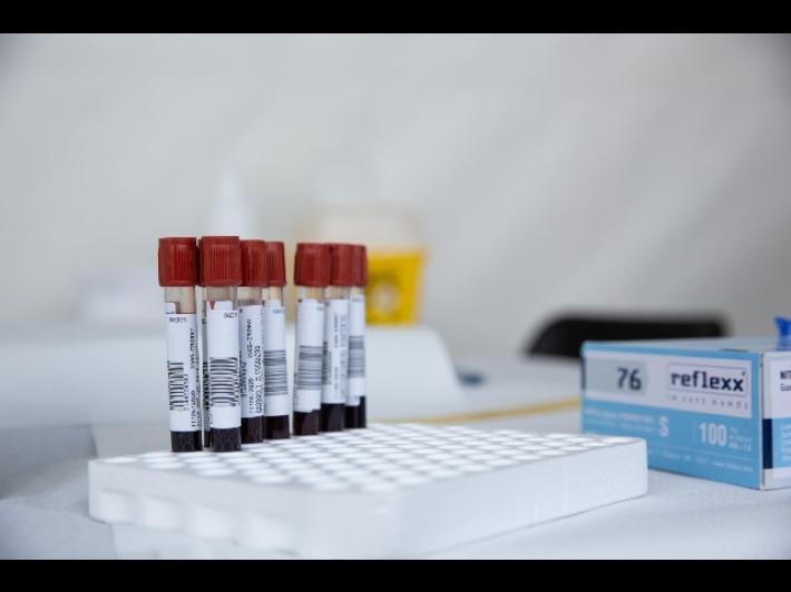 Covid,  in Italia calano i casi  (e aumentano i tamponi): sono 878. I morti sono 4