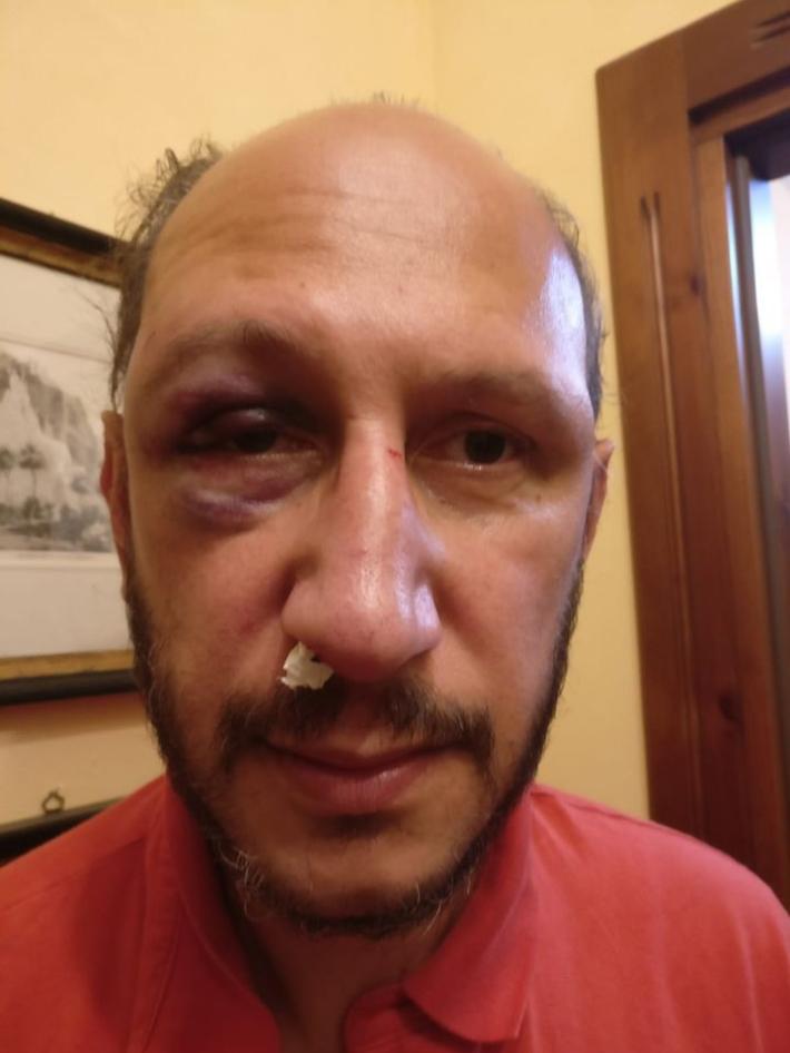 &laquo;Picchiato selvaggiamente perch&eacute; ho difeso un collega barista&raquo;