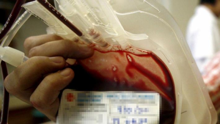 Emoderivati infetti, 56enne vince &laquo;a sorpresa&raquo; la causa