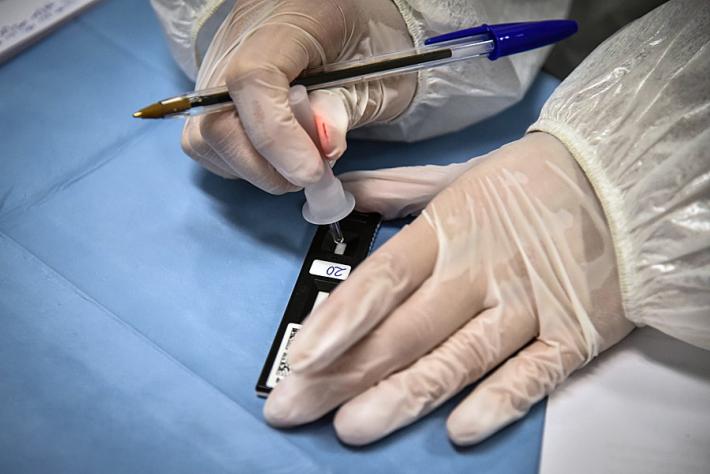 Covid: rilevare immunit&agrave; in 10 minuti, ora si pu&ograve;