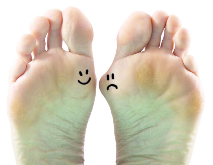 Alluce valgo,  quando servono  scarpe  comode. E quando il bisturi