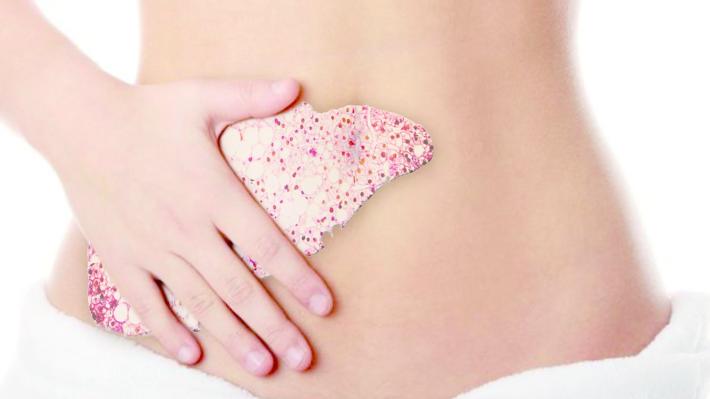 Meglio avere fegato purch&eacute; non sia grasso   