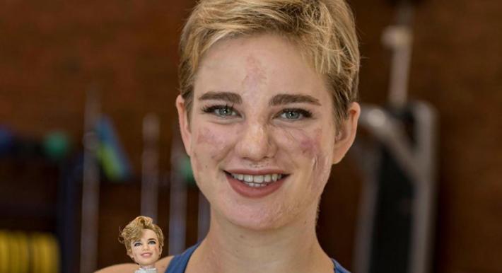 Al bar con  gli amici oltre il coprifuoco, multata Bebe Vio