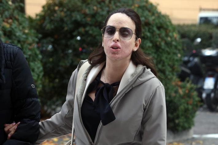 Cassazione condanna Tavares, sfregi&ograve; Gessica Notaro 