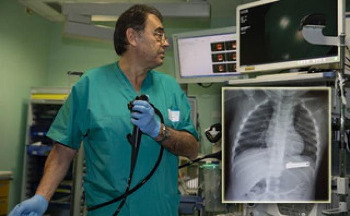 Bimbo di due anni ingoia un tagliaunghie: salvato