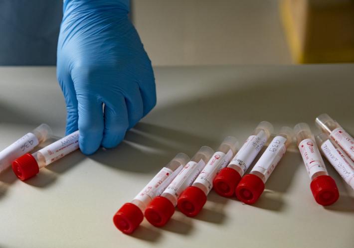 Aggiornamento informatico in ritardo: slitta la partenza dei tamponi a 15 euro