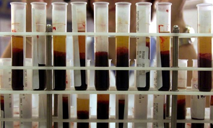 Trentacinque anni fa la trasfusione infetta, ora i soldi dovuti