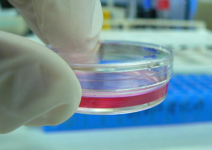 Studio Iss-S. Raffaele: gli anticorpi durano fino a 8 mesi indipendentemente da gravit&agrave; malattia ed et&agrave;&nbsp;