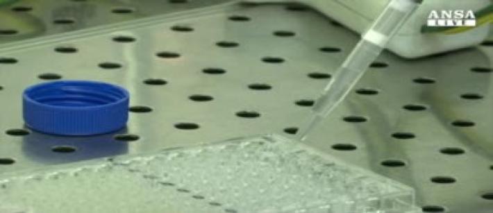 Boom morbillo in Italia, +230% casi da inizio anno Video