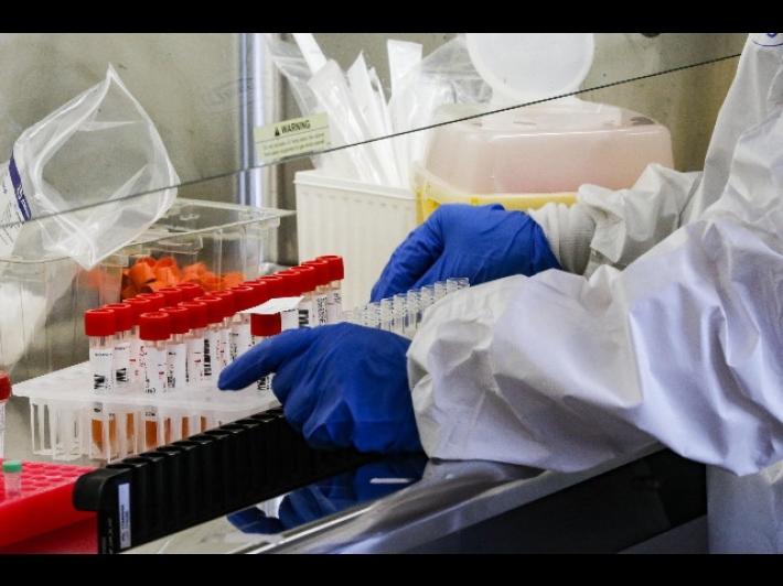 4717 positivi,125 morti di cui 24 riconteggio Campania