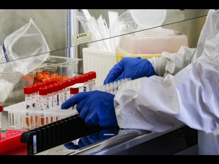 In Italia 1.820 nuovi casi (mai cos&igrave; bassi dal 30 settembre) e 82 morti. Tasso di positivit&agrave; al 2,1%