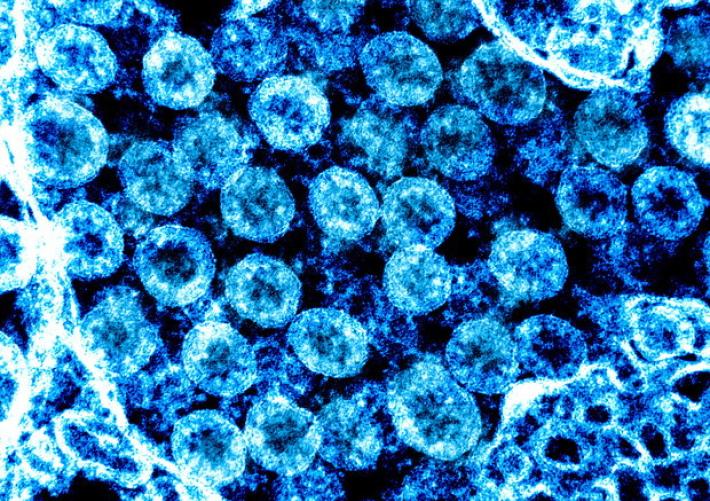 &nbsp;La luce solare 'uccide'&nbsp;il virus Sars-Cov-2  in pochi minuti