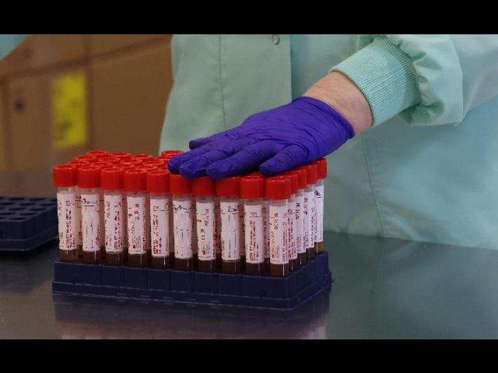 Con 27 nuovi casi Parma &egrave; seconda in Emilia Romagna per contagi, ma nessun decesso. Stabile il numero dei pazienti in terapia intensiva (5)