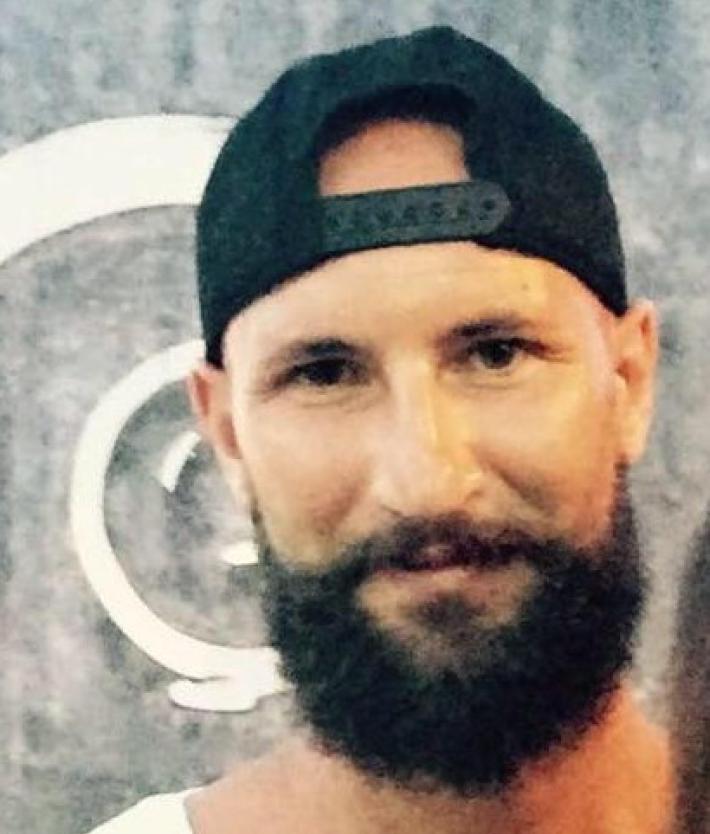 Mor&igrave; a 33 anni: &laquo;Anomalia congenita non riscontrabile prima o durante l'intervento&raquo;