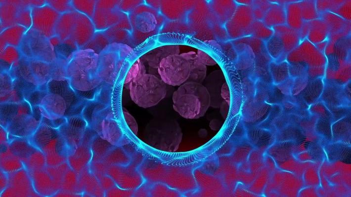 Tumore prostata, terapia riduce progressione o morte del 46%