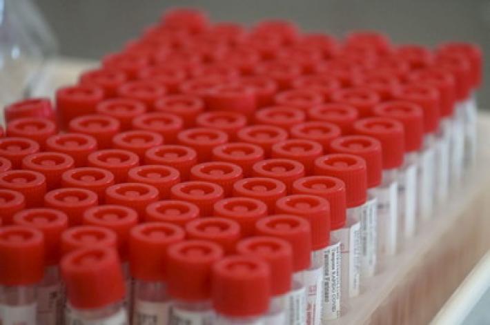 Scoperta la  chiave dell'invecchiamento cellulare: &egrave; nel riciclo