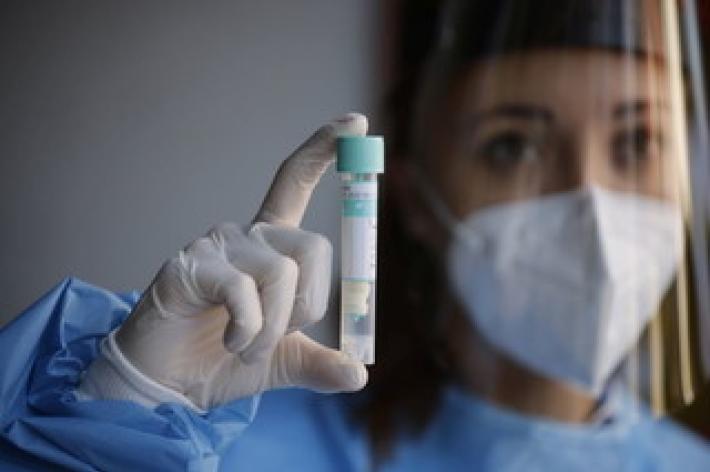 Covid, 1.612 nuovi casi e 37 decessi nelle ultime 24 ore in Italia