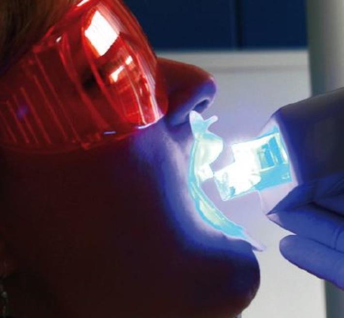 Con lo sbiancamento dentale torna il piacere di sorridere