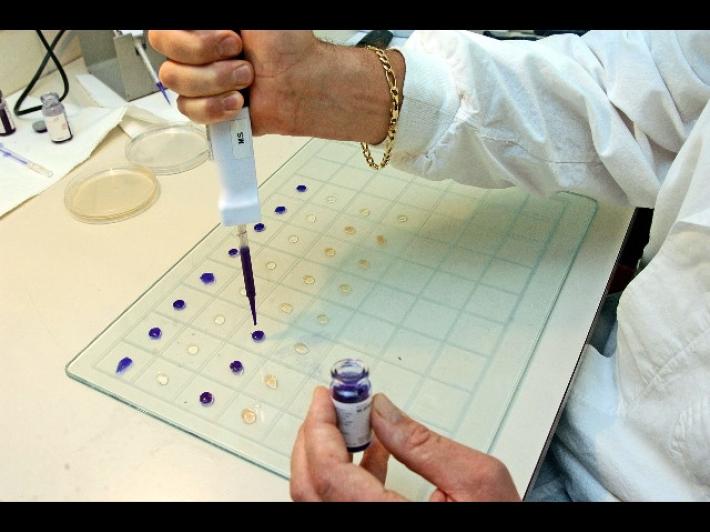 Gli anticorpi monoclonali evitano danni ai polmoni e al sistema nervoso