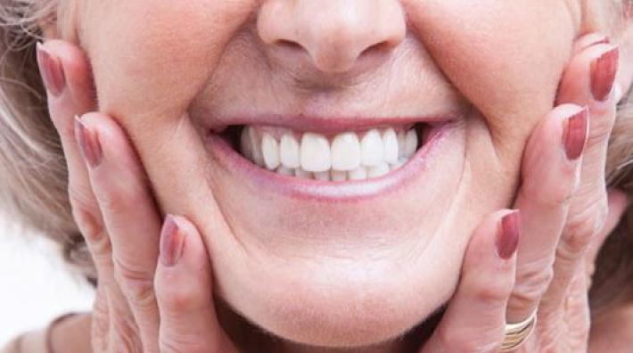Capsule, ponti e dentiere per non smettere di sorridere