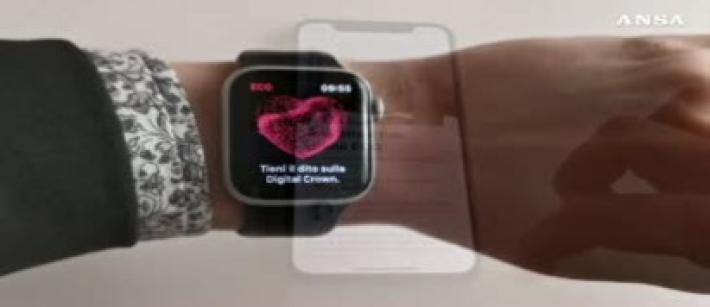 Su Apple Watch arriva l'elettrocardiogramma