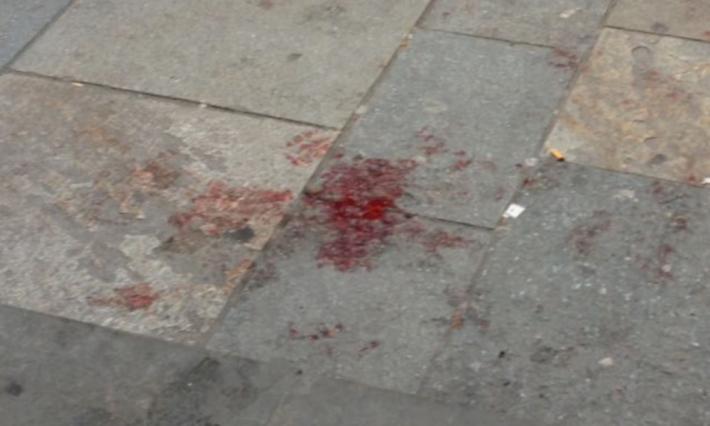 Quella pozza di sangue in via D'Azeglio. Cos'&egrave; successo?