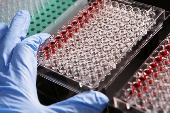 Mieloma multiplo: una ricerca dell&rsquo;universit&agrave; di Parma suggerisce una nuova via per prevenire le lesioni ossee