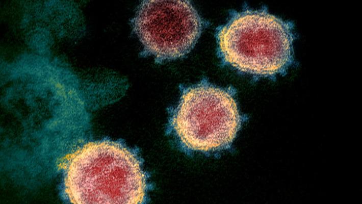 Continua l'ondata di nuovi contagi: a Parma +113. C'è un decesso. Terza dose: ora ci sono anche i medici di famiglia