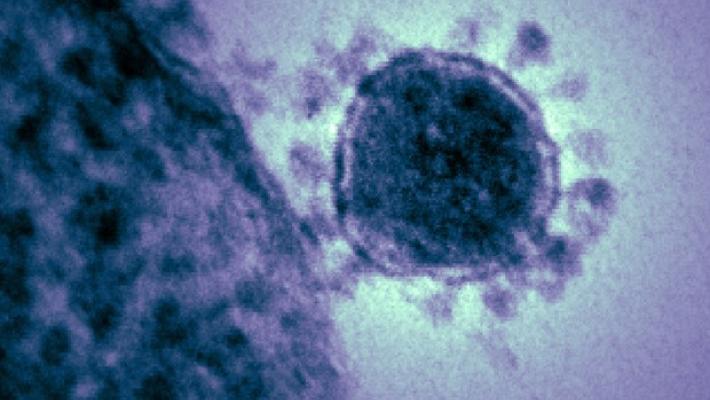 L'aggiornamento in Emilia-Romagna: 3.904 nuovi casi. Oltre 2.100 guariti, in calo i ricoveri in terapia intensiva (-1) e negli altri reparti Covid (-98). Vaccinazioni: raggiunto il 93,8% di copertura 