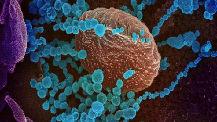 Coronavirus: a Parma 80 nuovi casi e due morti (due donne di 82 e 93 anni)
