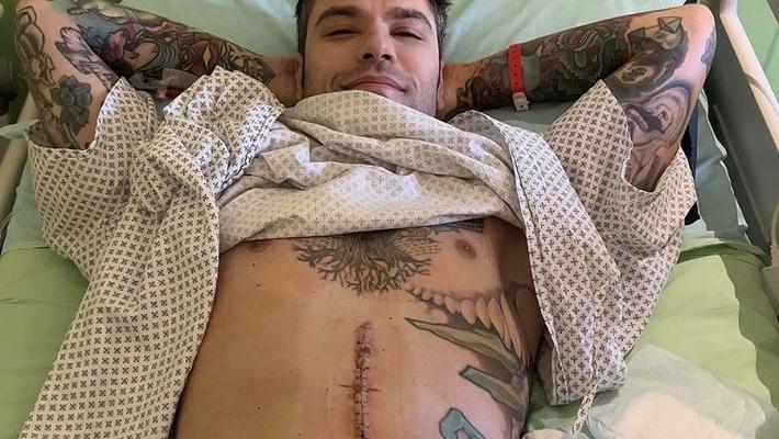 Fedez, scoperto raro tumore neuroendocrino del pancreas 