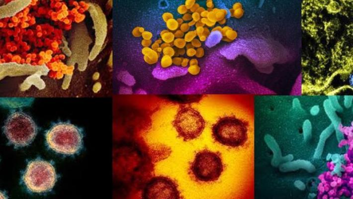 Terzo giorno senza decessi a Parma. Ma con 136 nuovi contagi 