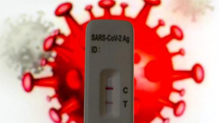 Covid, ancora una vittima a Parma (e 7 totali in Regione). I nuovi casi sono 22  e 228 in Emilia Romagna