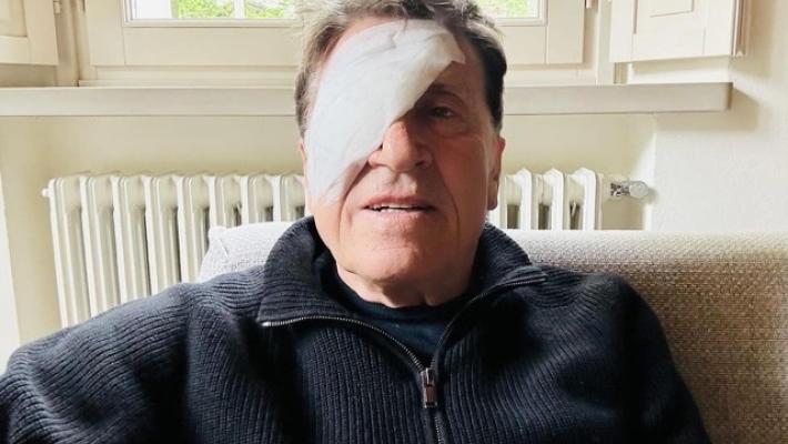Gianni Morandi bendato su social scherza, 'ho fatto a pugni' 