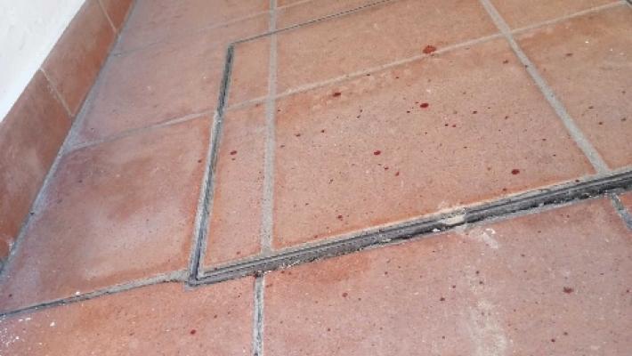 Donna colpita al volto da pietra, 'ho fatto tutto da sola'