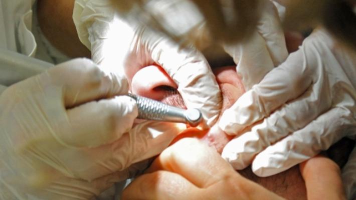Operato ai denti in Albania, da 8 mesi in ospedale