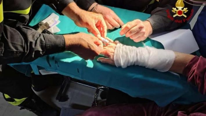 Anelli non si sfilano da mano della paziente, intervento Vvf