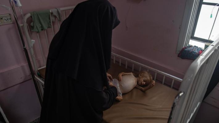 Wafa, morti di fama a Gaza altri 2 bimbi, 152 dal 7 ottobre