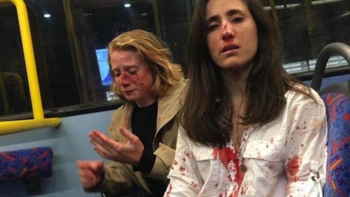 Lesbiche rifiutano di baciarsi sul bus, picchiate da omofobi