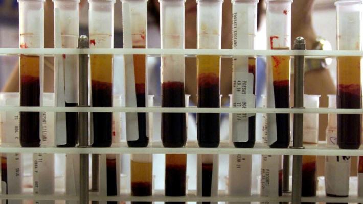 Mezzo secolo fa le trasfusioni infette, ora i soldi dovuti