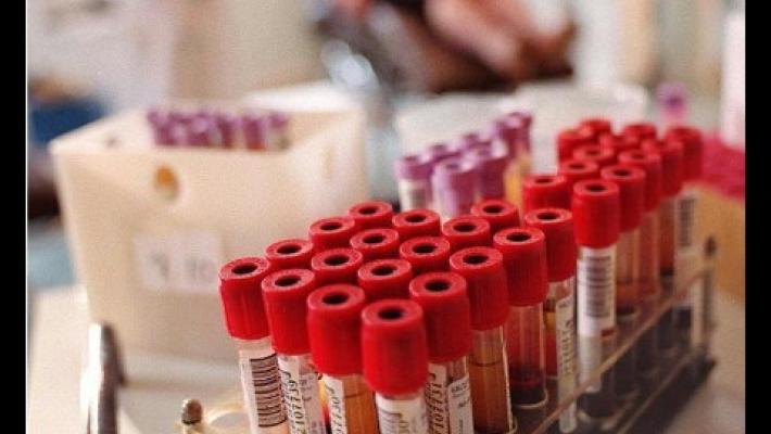Sei immune al Covid? Un nuovo test rapido lo misurerà in meno di 24 ore