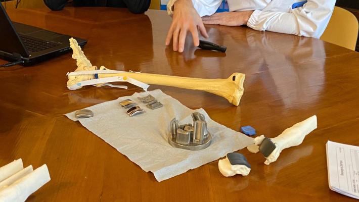 Caviglia ricostruita in 3D al Rizzoli di Bologna: è prima volta al mondo 