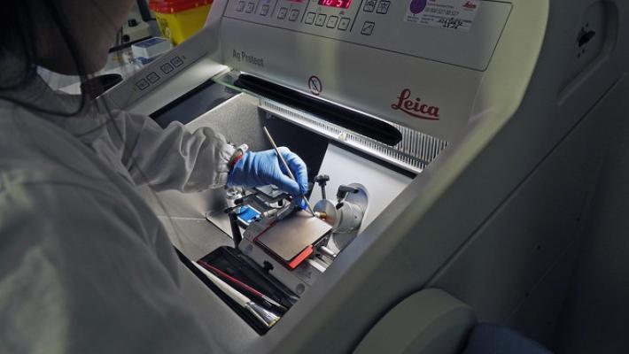 Trapianto renale, a Parma un nuovo strumento di  ricerca e diagnosi