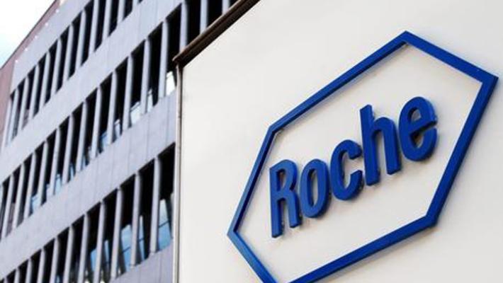 Roche, messo a punto un nuovo test sierologico