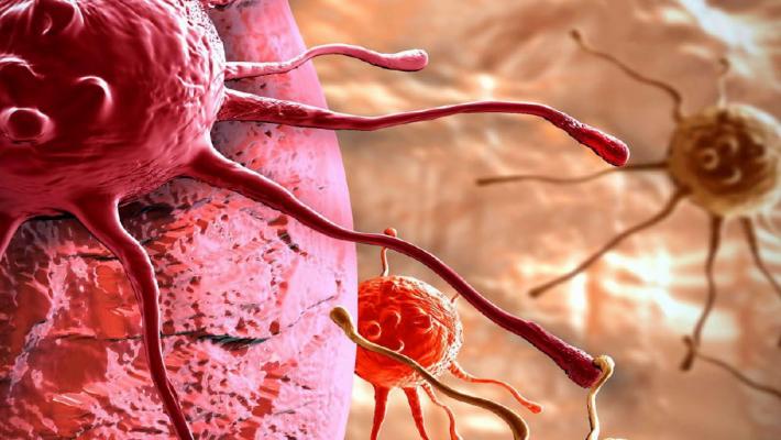 Australia, estratto un verme parassita dal cervello di una donna