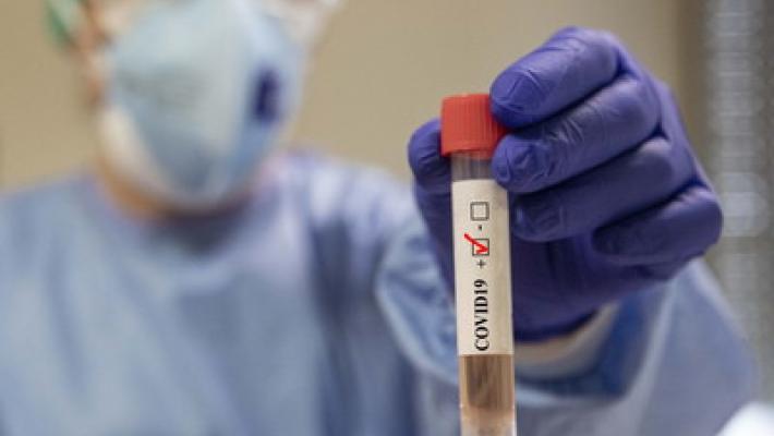 Coronavirus, allo Spallanzani isolato nelle lacrime di una paziente