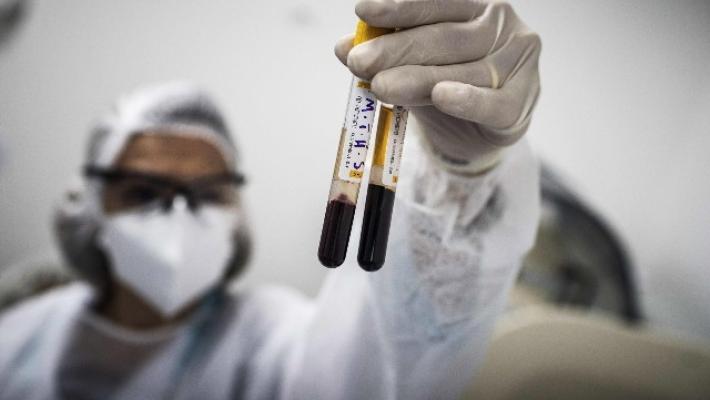 Nessun morto a Parma nelle ultime 24 ore e solo 4 nuovi casi. La situazione migliora in tutta la regione