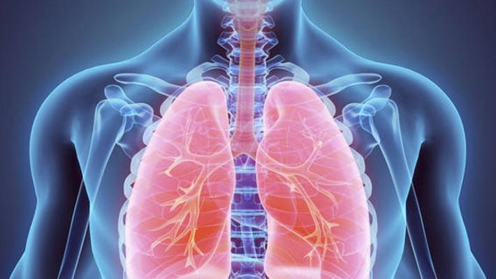 Il 30% dei guariti Covid avrà problemi respiratori cronici