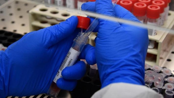 Non ci sono morti a Parma nelle ultime 24 ore, 2 nuovi positivi. 6 decessi in tutta la regione